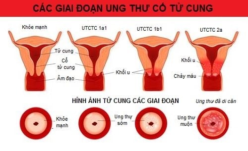 anh-cac-giai-doan.jpg